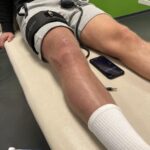 Blood Flow Restriction Training: Rehab & Performance